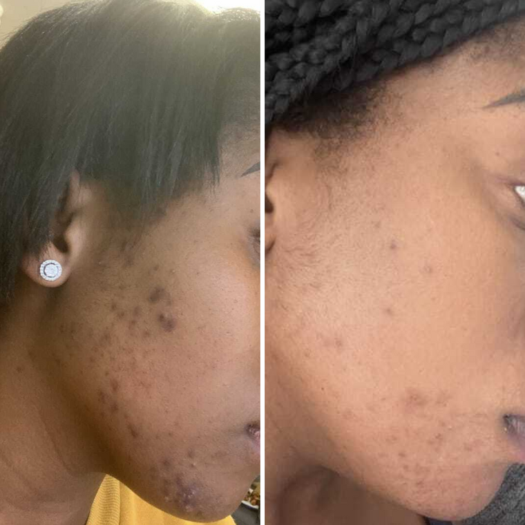 Jane D. customer result