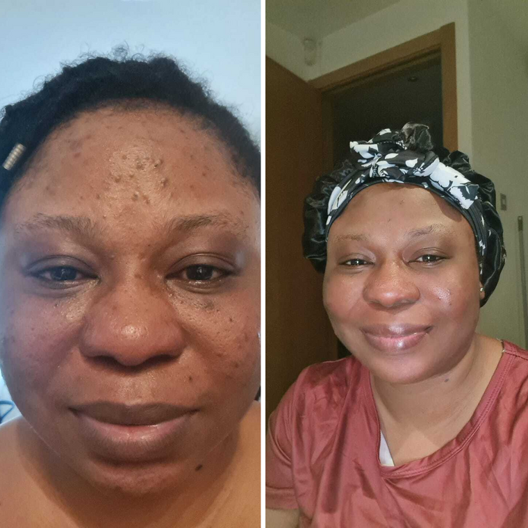 Nicole D. customer result