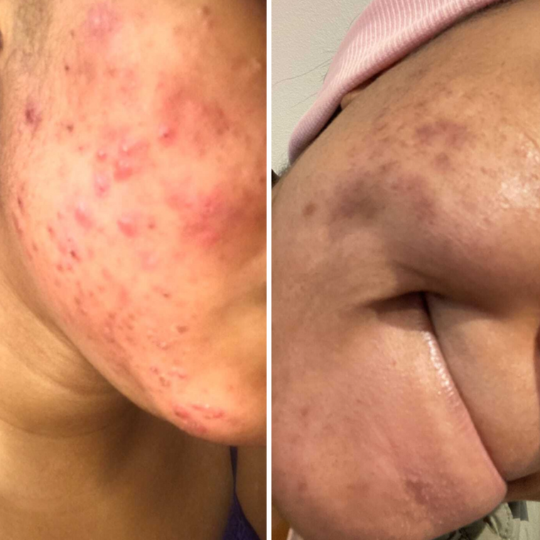Rachel S. customer result