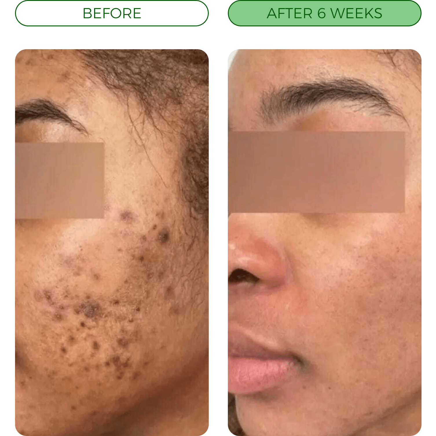 Before and after turmeric soap result