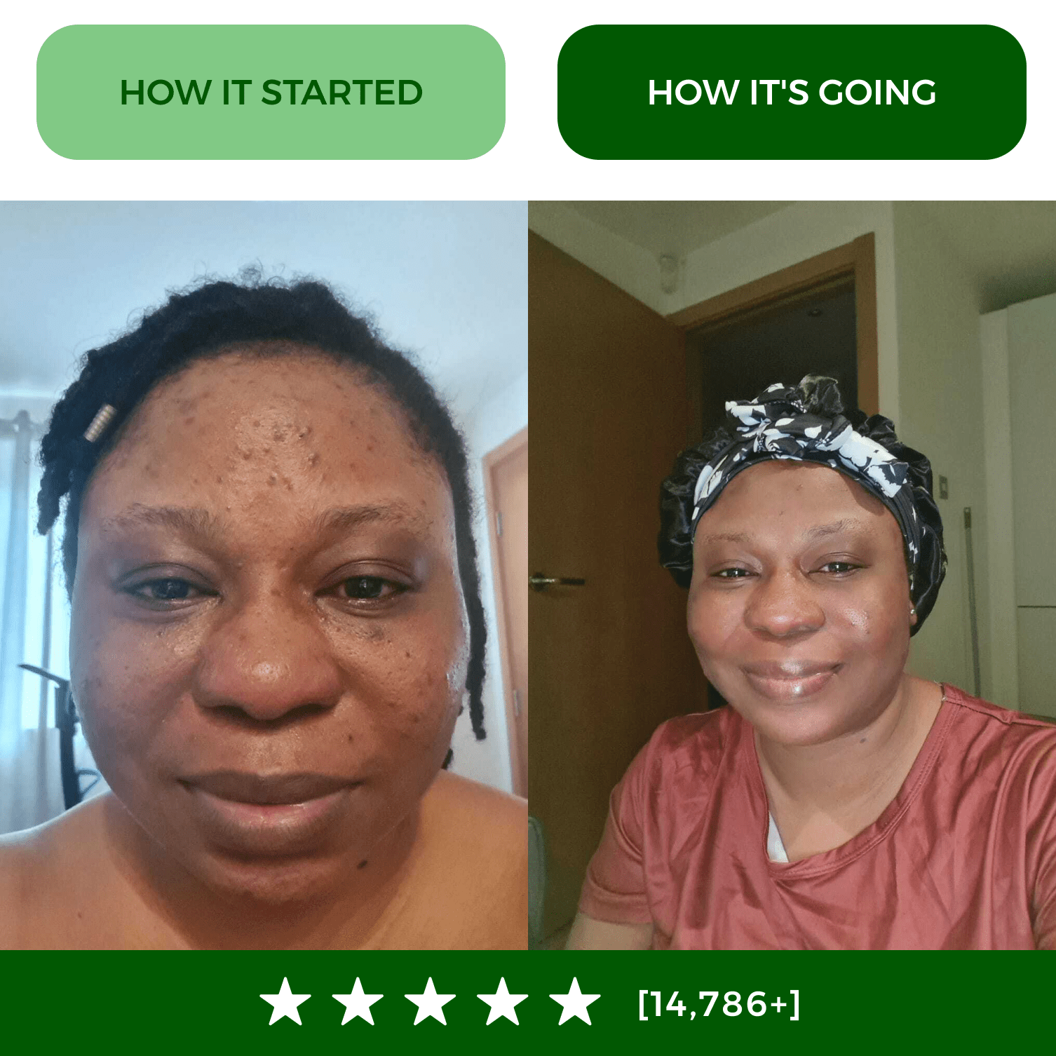 Turmeric Fade & Glow Bar.