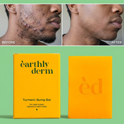 Turmeric Bump Bar