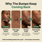 Turmeric Bump Bar