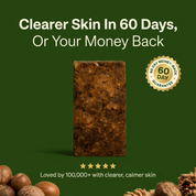 Anti-Acne & Blemish Bar.